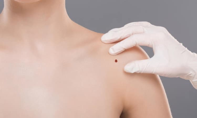 Dermatologische Expertise: Dr. Balázs bietet individuelle Betreuung auf höchstem Niveau