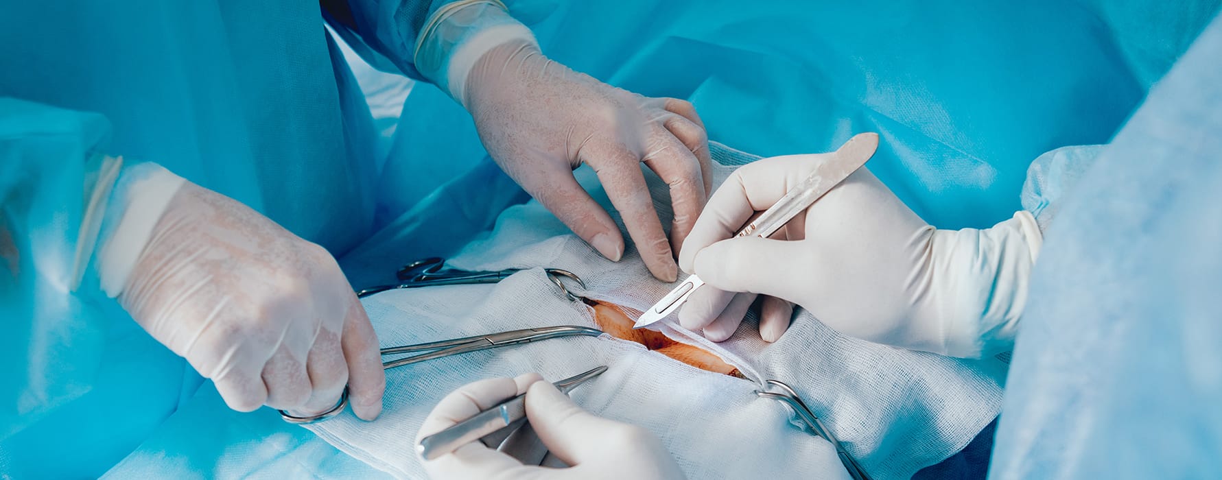 Warum sich Patienten weltweit für eine Magenverkleinerung Türkei entscheiden